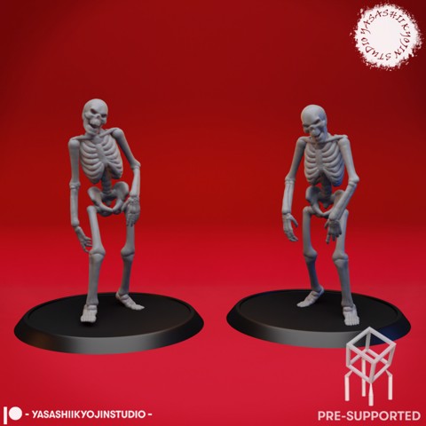 Image of Undead Skeleton Walkers - Tabletop Miniature (Pre-Supported)